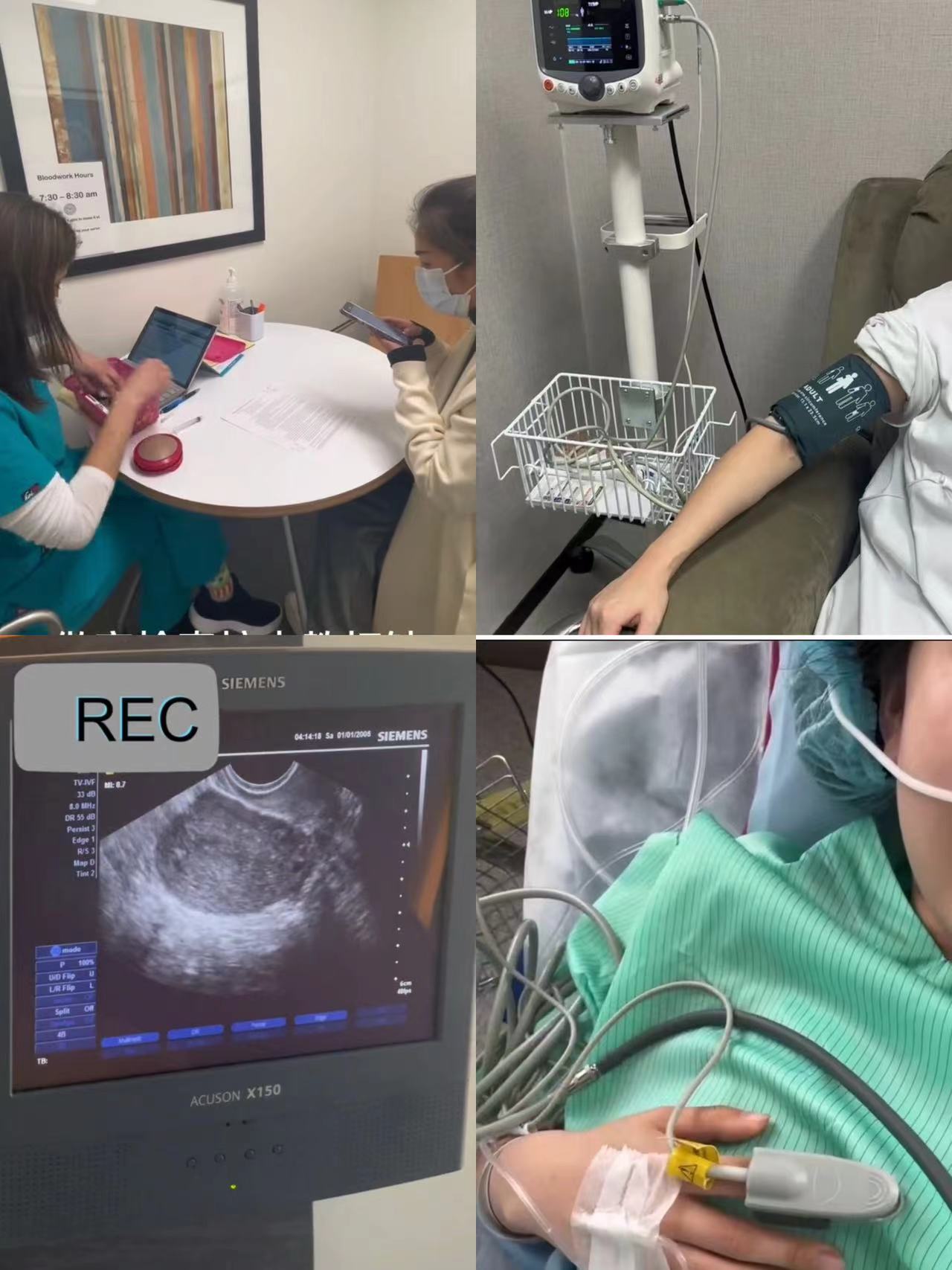 35岁居然还能冻卵18颗，我很满意